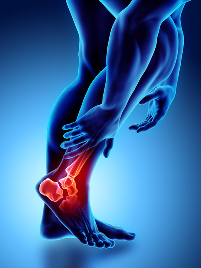 Ankle Injury Treatment in McKinney Texas